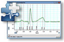 ECG Analysis