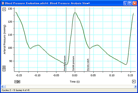 動脈圧Analysis View