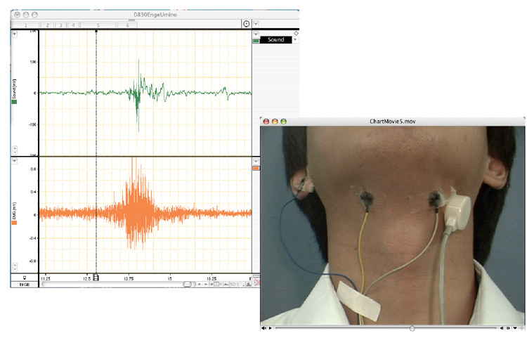 嚥下動作の動画と嚥下音および筋電図を同期記録した例